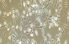 MDA-MB-435s Cells