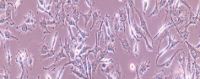 HEB Cells