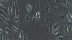 ARPE-19 Cells