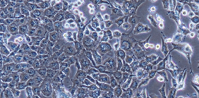 HuH28 Cells