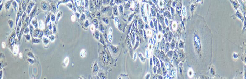 NCI-H1688 Cells