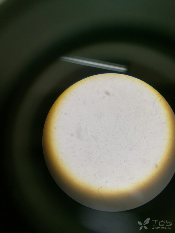 链球菌油镜图片