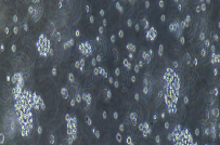 NCI-H526 Cells