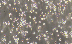 THP-1 Cells