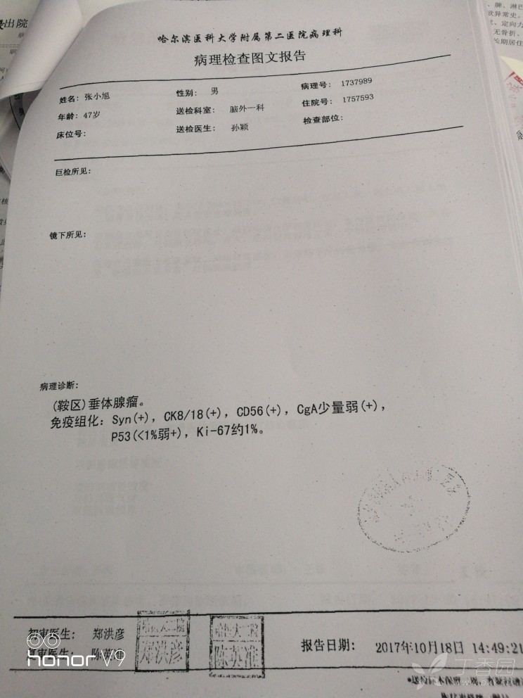 垂体腺瘤术后病理结果不会看呀!哪位神经外科医生帮忙指点一二