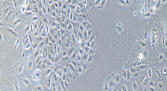 NCI-H2126 Cells