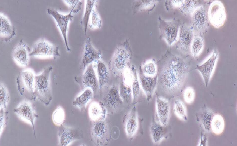ECV-304 Cells