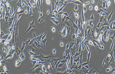 SK-MEL-1 Cells