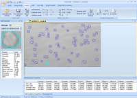 细胞分析软件 细胞计数 轨迹追踪