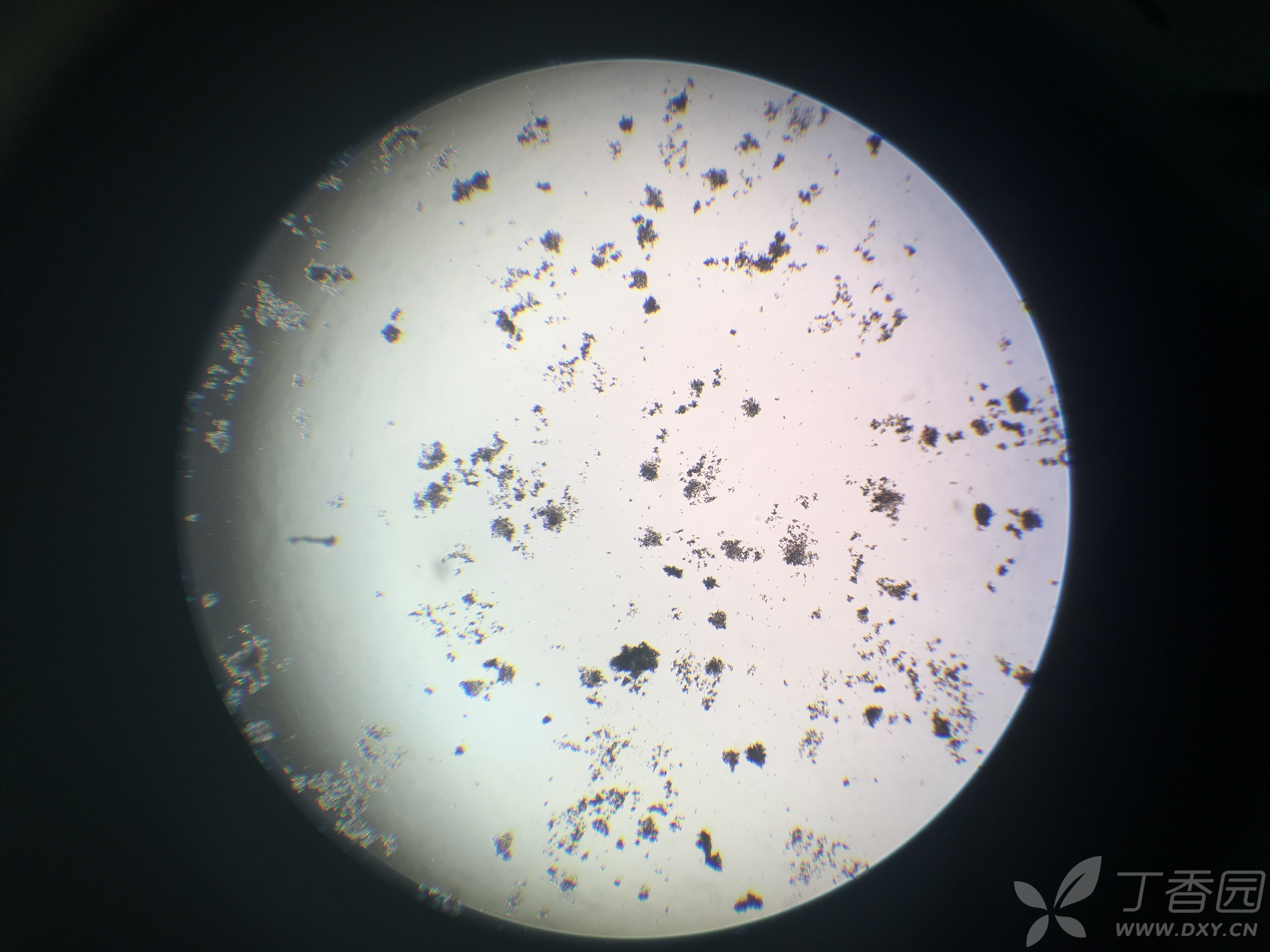 这是酵母菌污染吗?求助!