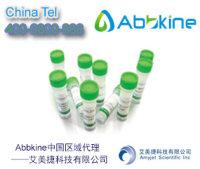 APG7/ATG7抗体|APG7/ATG7 Antibody，APG7L，ATG7，DKFZp434N0735，GSA7