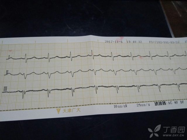 3242633530334293656-16w.jpg!w640