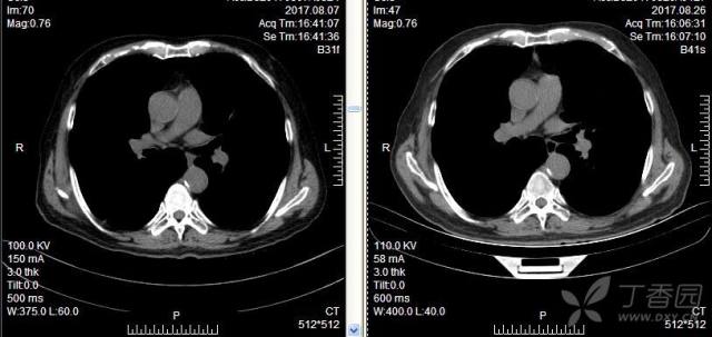 抗真菌治疗副作用 3242603317386895237-8w.jpg!w640