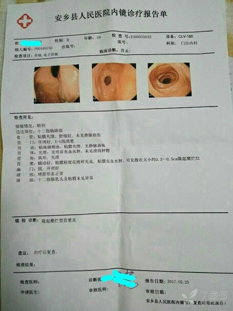 胃窦胃体多发小隆起