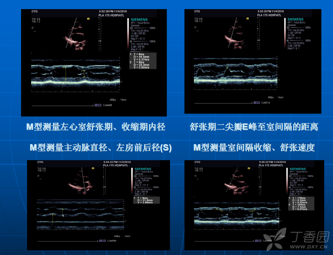超声心动图规范化操作(175医院刘倚河).ppt(6732.5k) 点赞