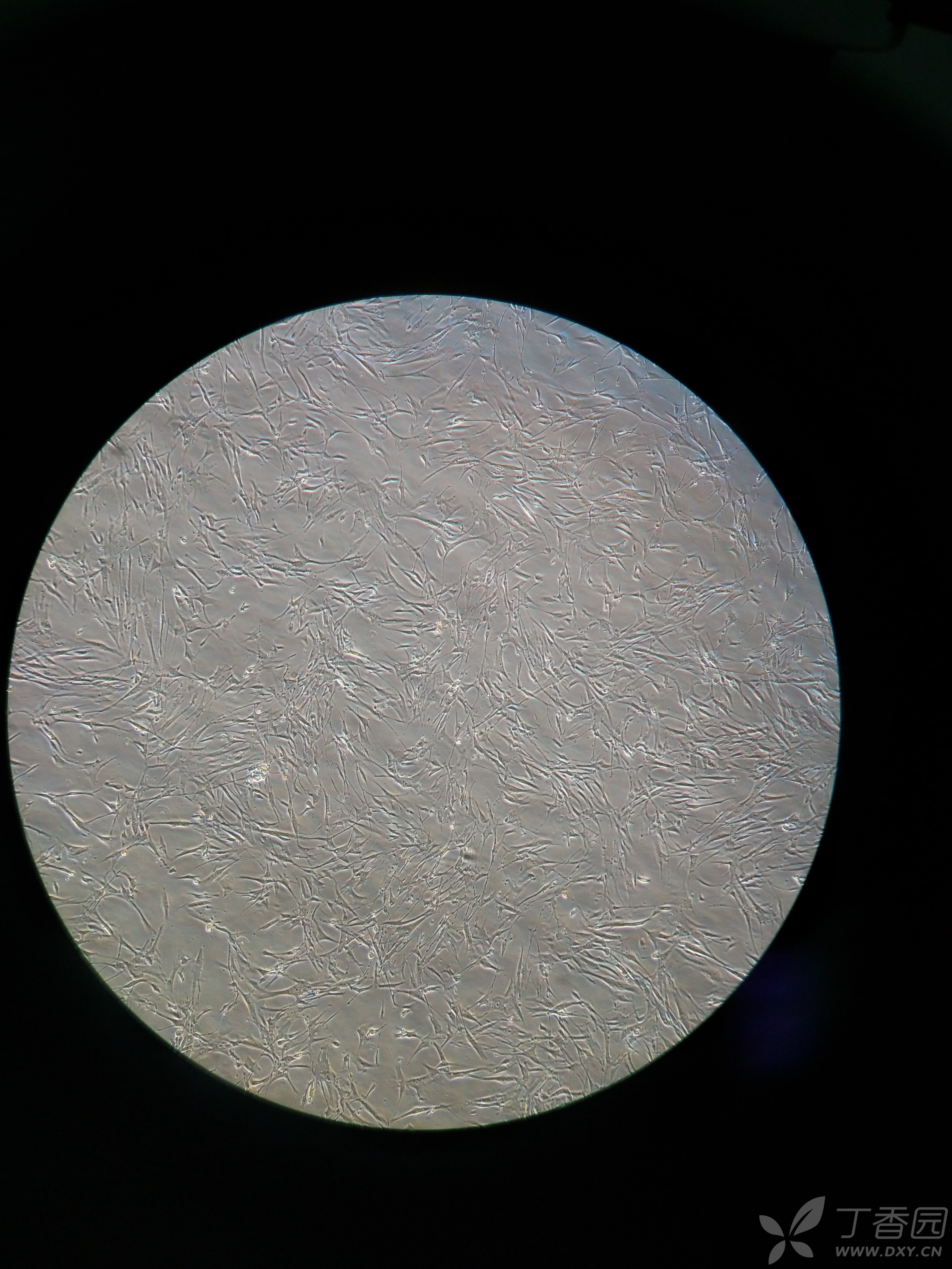 成纤维细胞电镜图图片