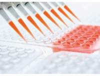 人血管内皮生长因子(VEGF)试剂盒