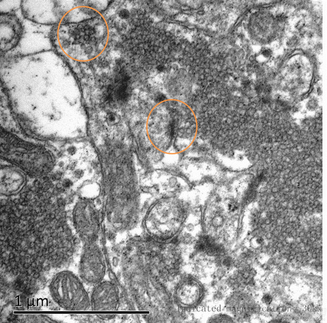 突触电镜的问题求大神