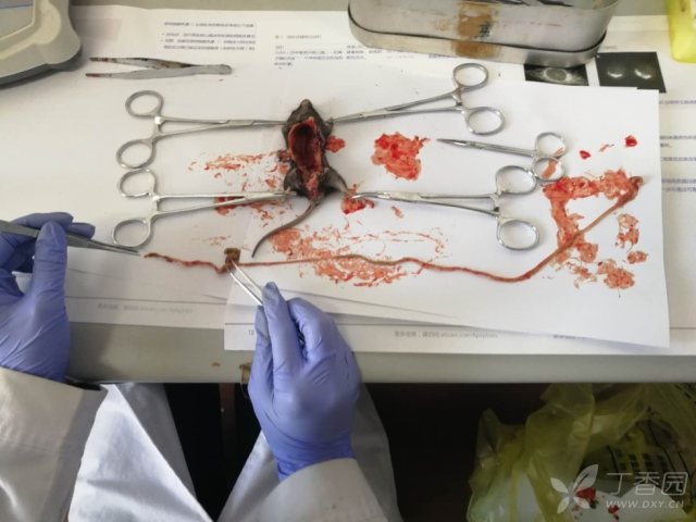小鼠结肠区分 实验动物与生化组胚 专业医生社区,医学,药学,生命