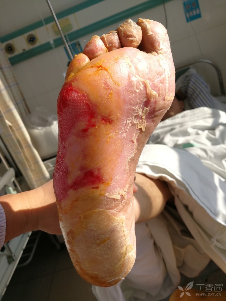 有见过类似病历的吗? [病例帖]