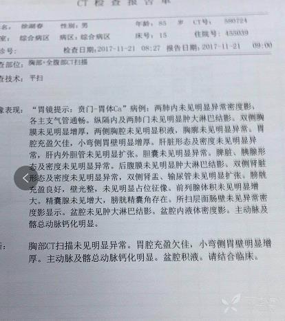 關於胃癌的ca 199指標,請教大家