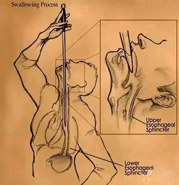 胃镜的发明竟然来源于吞剑表演?