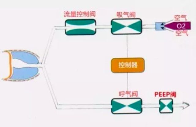 呼吸机呼气末正压 呼吸机参数详解：呼气末正压