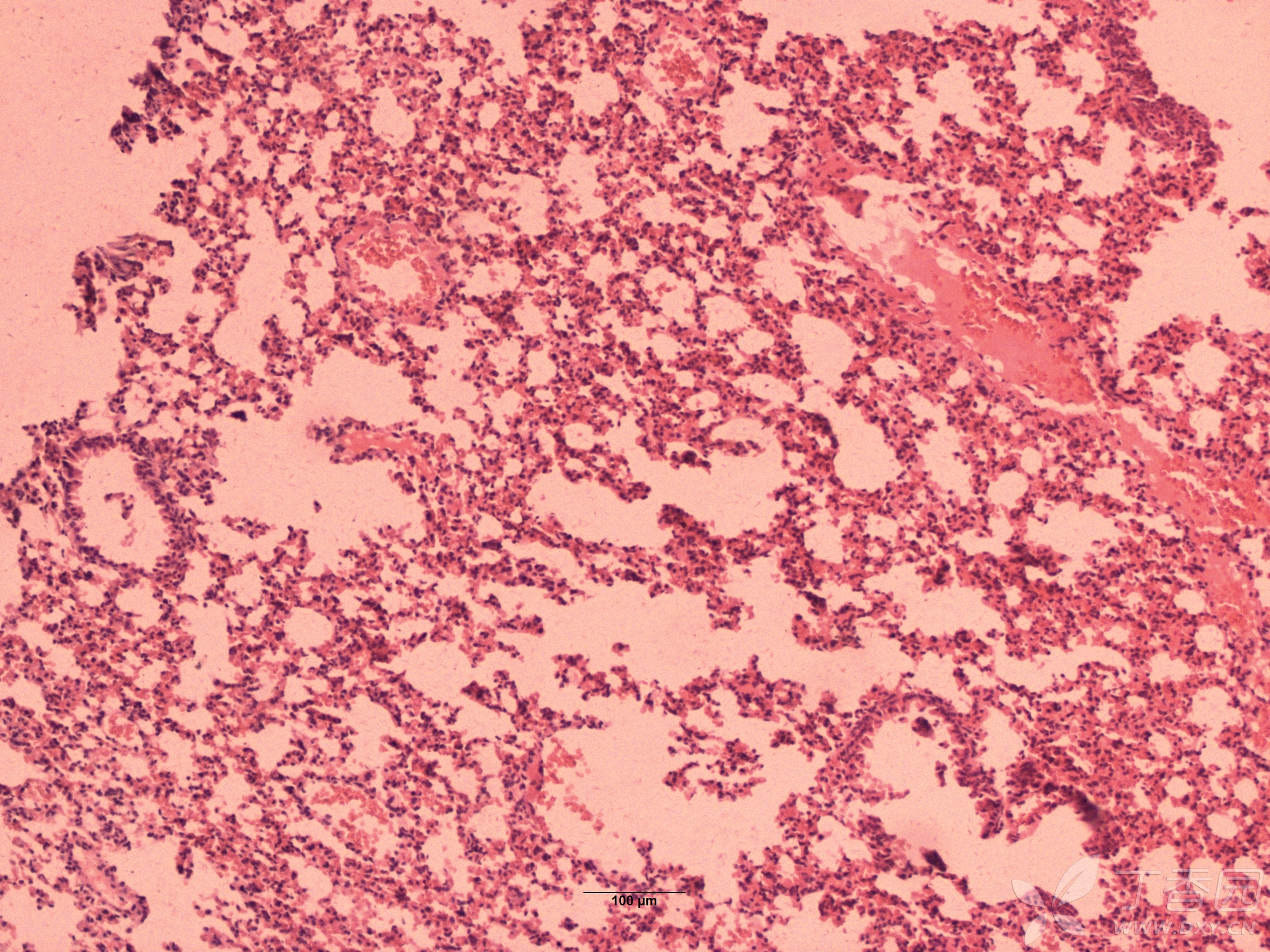 小鼠肺组织切片图片