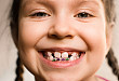 正畸系列病例（三）：做好正畸治疗「后勤工作」，良好口腔卫生巩固牙周健康