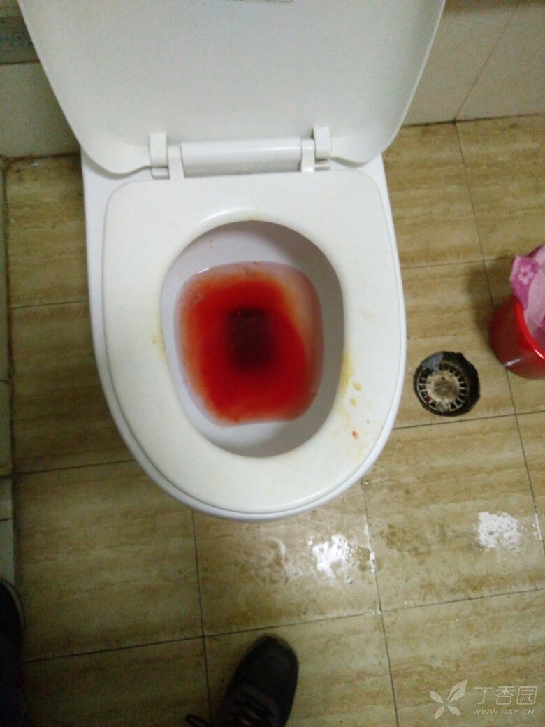 血尿马桶图片