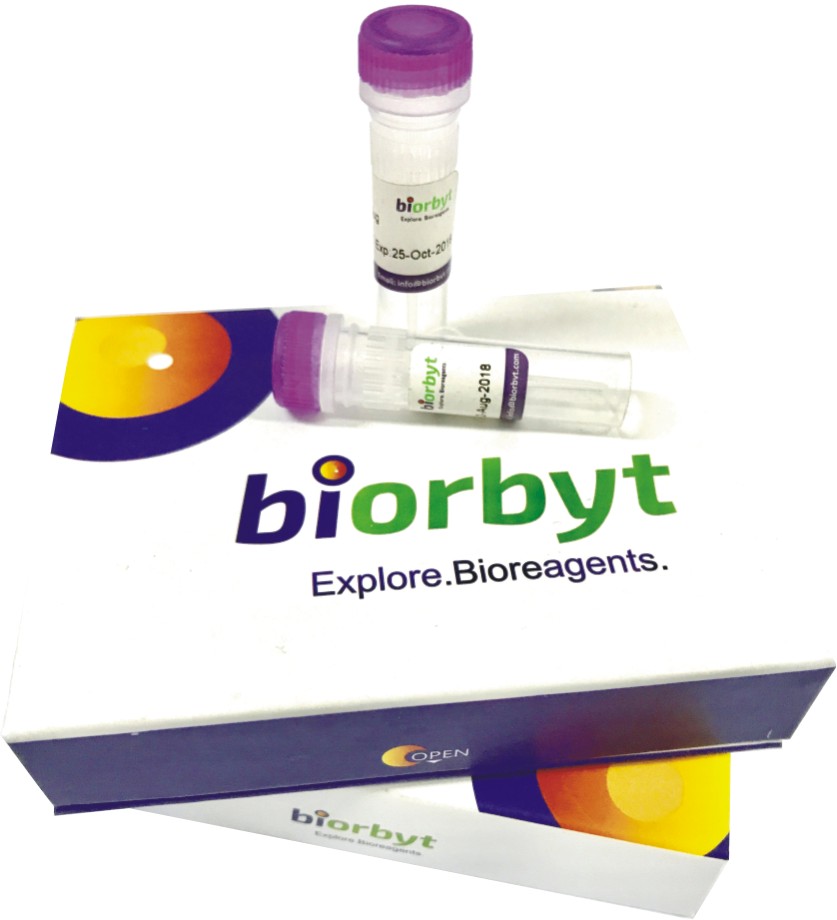 Goat AntiHuman IgG (H&L) (Alexa Fluor 647) antibody价格_品牌biorbyt丁香通官网