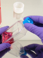 MDA-MB-175-VII细胞