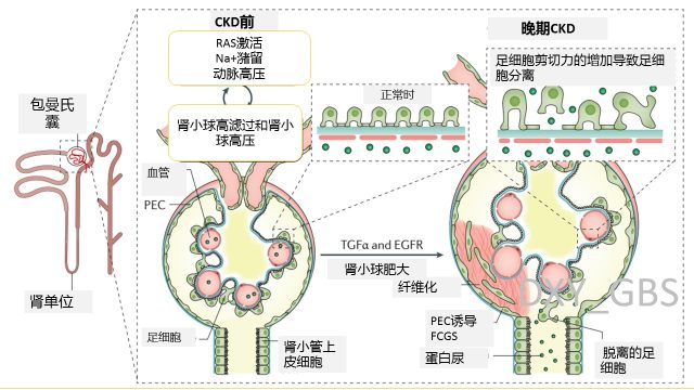 肾脏的解剖及病理生理 缓慢肾脏病：发病机制及病理生理进程