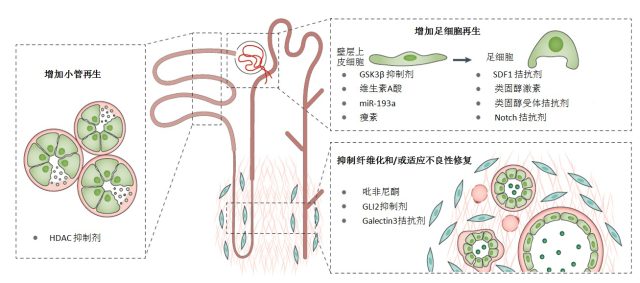 缓慢肾脏病分期 缓慢肾脏病：未来的研讨方向