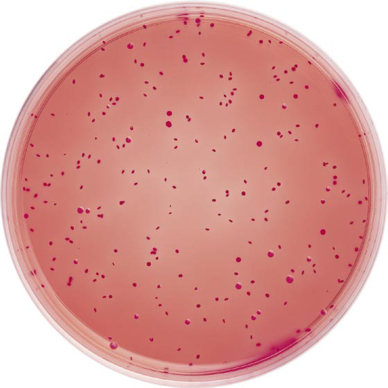 霉菌和酵母菌显色培养基规格