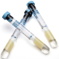 BD Vacutainer® CPT™单个核细胞制备管 PBMC管