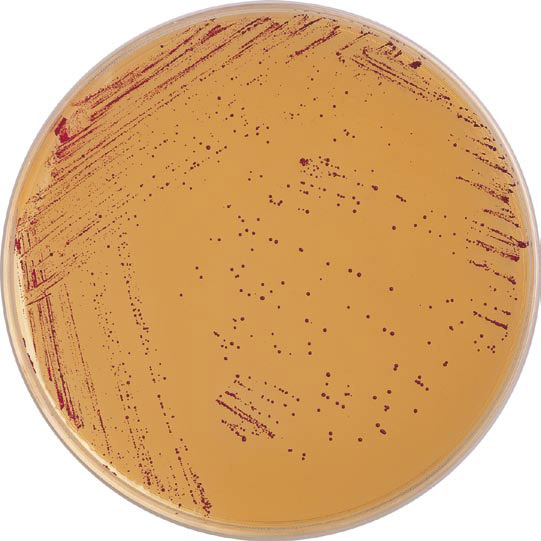 阪崎杆菌显色培养基规格