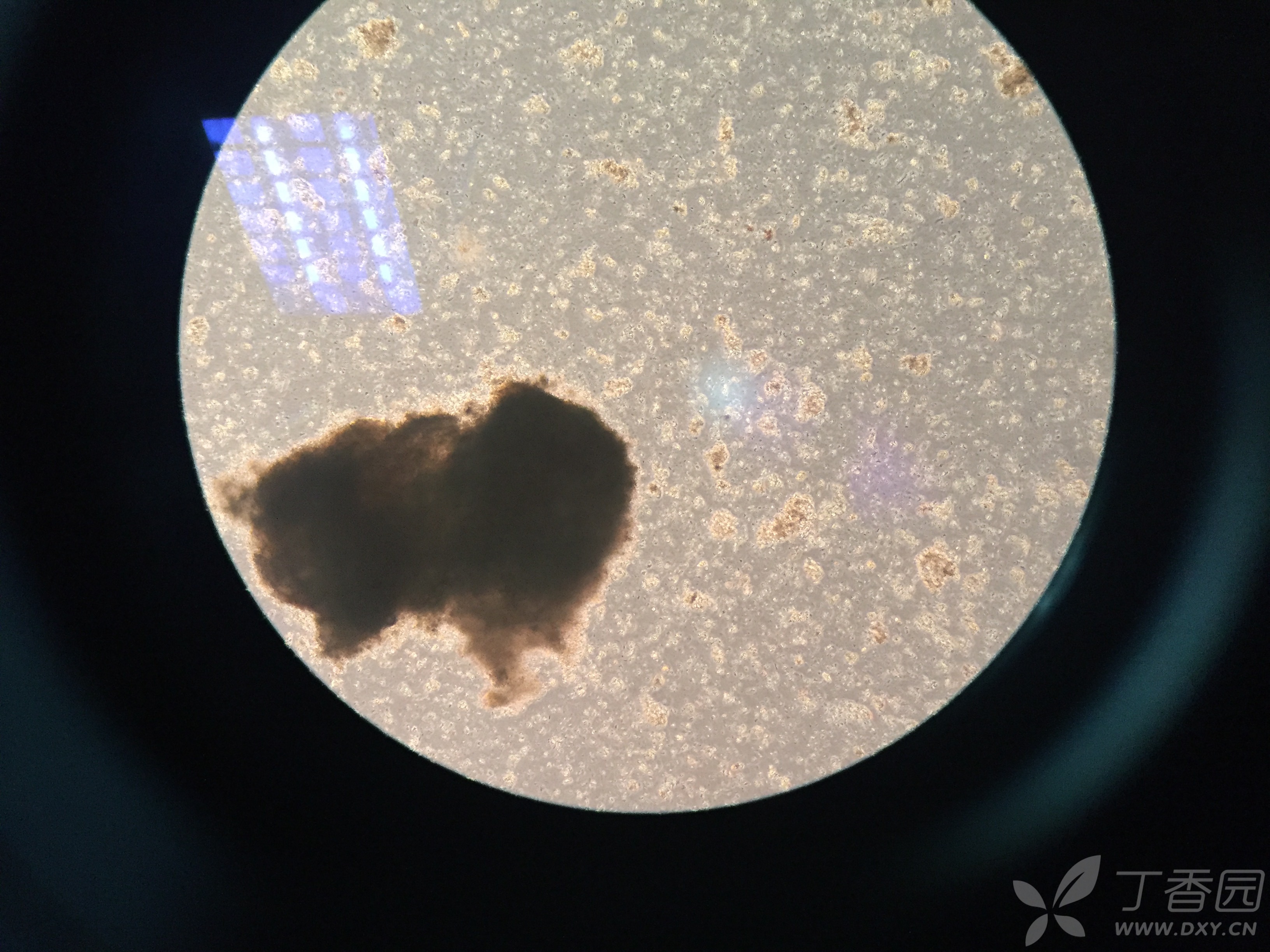 求救,组织块培养间充质干细胞