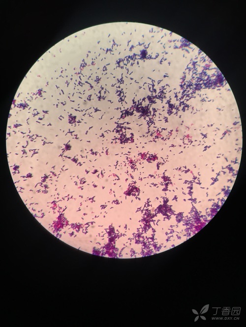 乳酸杆菌图片显微镜下图片