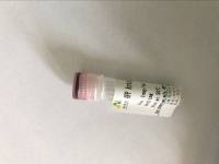 还原辅酶Ⅰ抑制剂 NADH Inhibitor