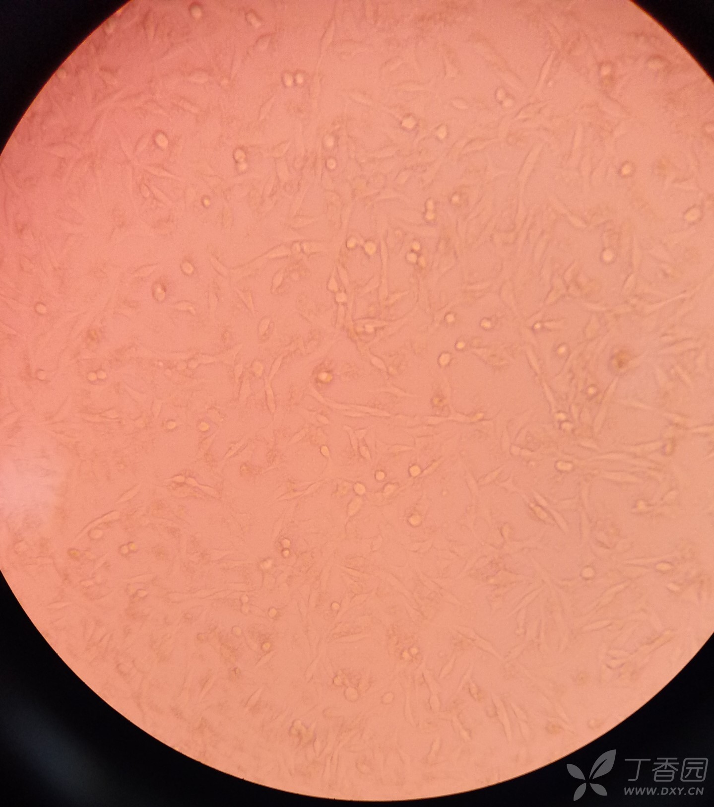 但是还是觉得形态怪怪的,麻烦大家帮我看一下这个到底是不是bv2.