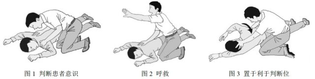 平安好医生医生可信吗 夜班平安攻略：3 步搞定心肺复苏