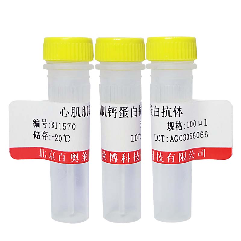 巨核细胞白血病2抗体北京价格
