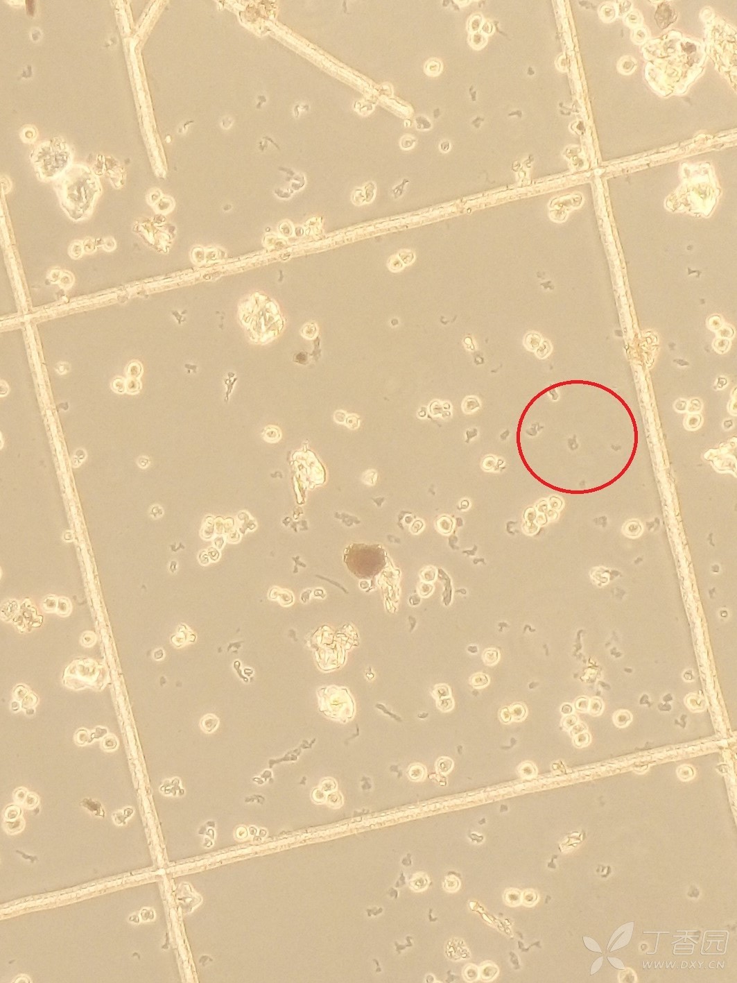 细胞不明原因大片死亡