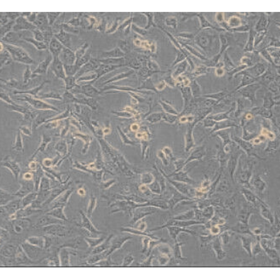 4T1小鼠乳腺癌细胞