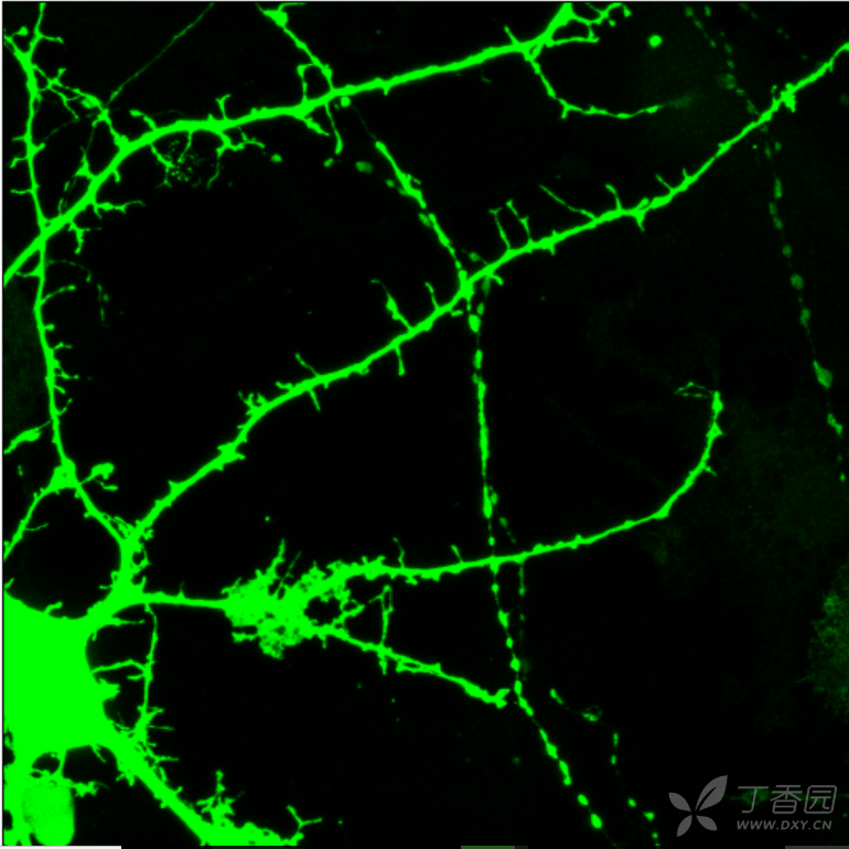 细胞免疫荧光用MAP2标记神经元后观察spine - 神经生物学讨论版 -丁香园论坛