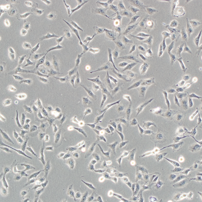 MKN28胃癌细胞