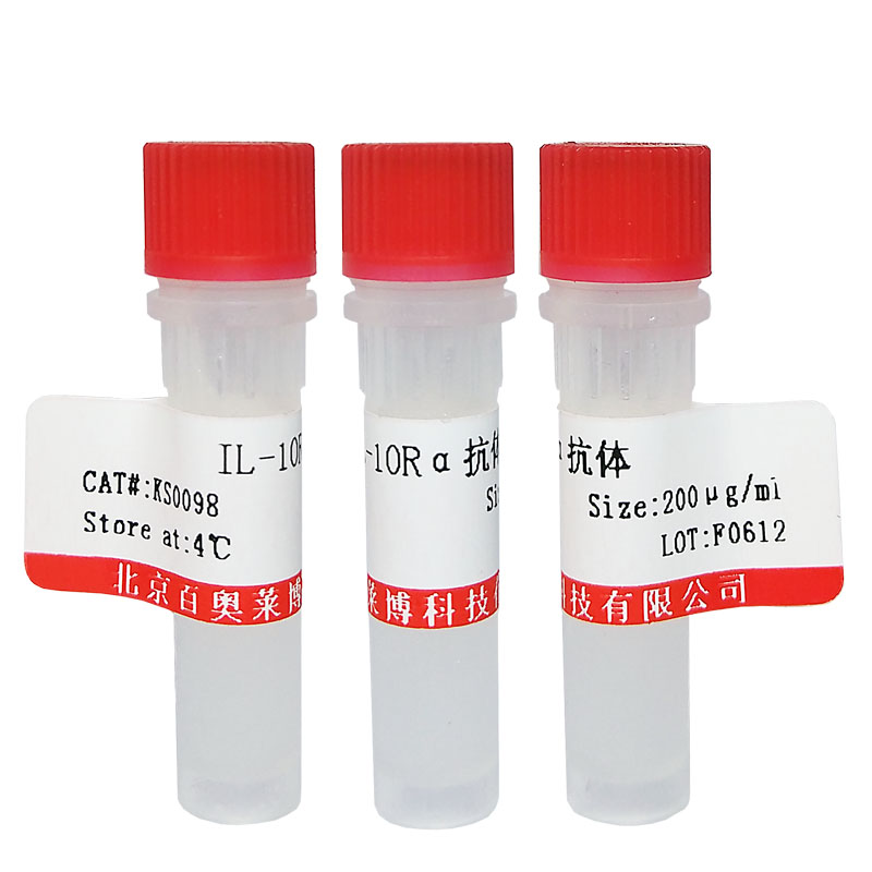 北京K18349型磷酸化IKKγ (Ser85)抗体促销