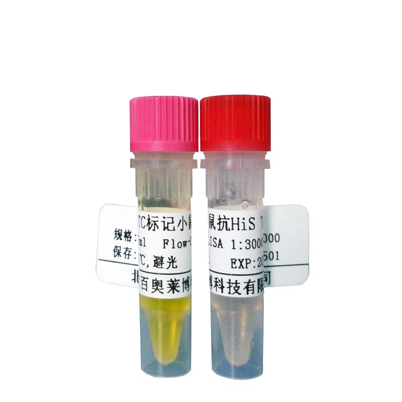 北京K10587型ANKS3抗体厂商