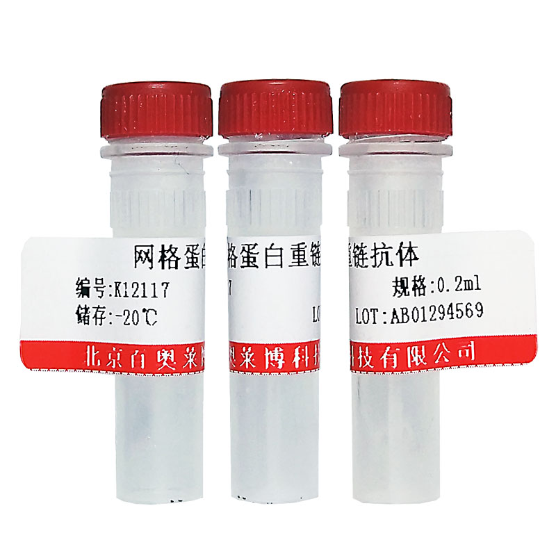 北京现货K21115型METTL2B抗体促销